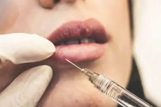 A gloved hand holds a syringe, preparing to inject a woman's lips.