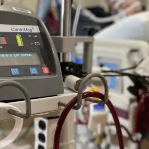A CentriMag heart pump machine in a hospital room.
